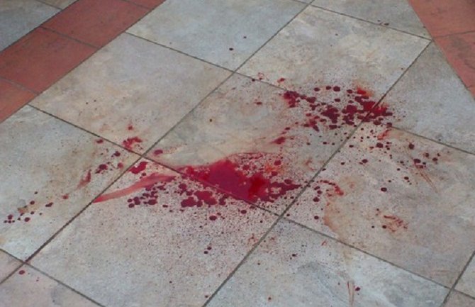 Pokosio dječaka (13) u blizini kuće!