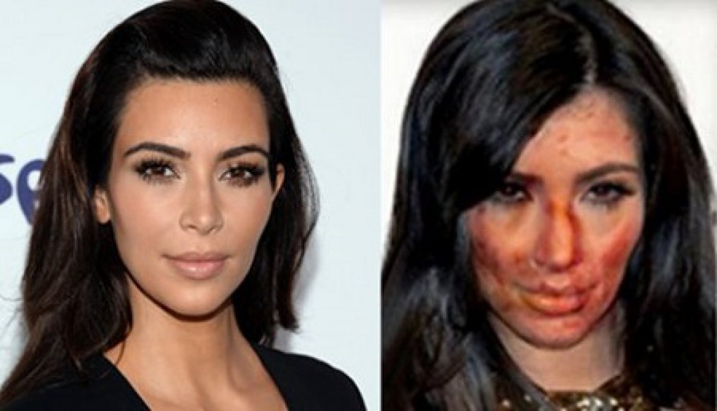 kim