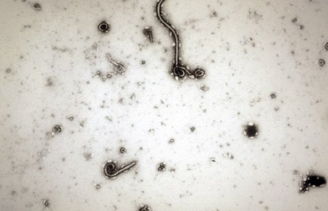 Hitan sastanak SB u četvrtak o eboli