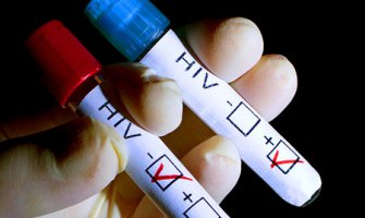 Petogodišnje dijete ima HIV