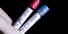 Testovi na HIV u apotekama (VIDEO)
