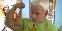 Top 10 bizarnih medicinskih stanja(VIDEO)