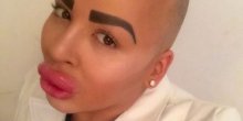 Potrošio je bogatstvo da bi ličio na Kim Kardašijan, a sada trpi strašne posljedice! (VIDEO)