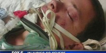 Dvadesetrogodišnjaku eksplodirala e-cigareta u ustima (VIDEO)