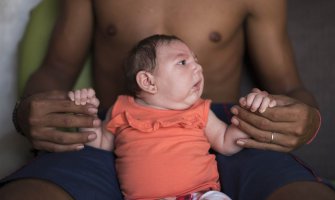Prvi slučaj da je virus zika prenijet sa čovjeka na čovjeka u SAD