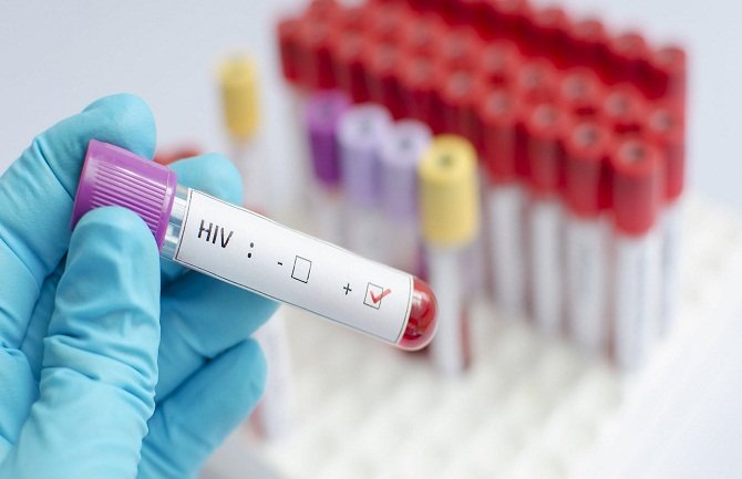 Sa HIV-om se danas živi! 