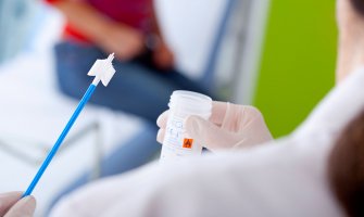 Tri mjeseca ne sprovode testiranja na hlamidiju, nestašica testova