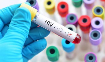 Besplatno testiranje na HIV/AIDS 7.decembra