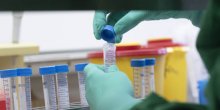 Kina  odobrila test za brzo otkrivanje koronavirusa: 400 pacijenata za 130 minuta (VIDEO)