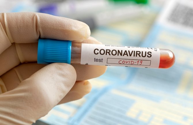Nova tri slučaja korona virusa
