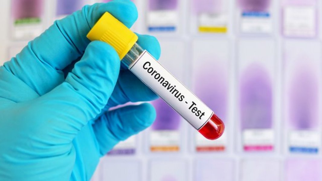 1582777270koronavirus