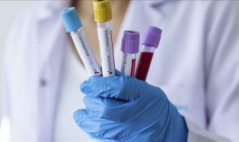 U BiH ukupno 43 smrtna slučaja, najviše u Banjaluci zaraženih koronavirusom