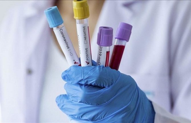 U BiH ukupno 43 smrtna slučaja, najviše u Banjaluci zaraženih koronavirusom