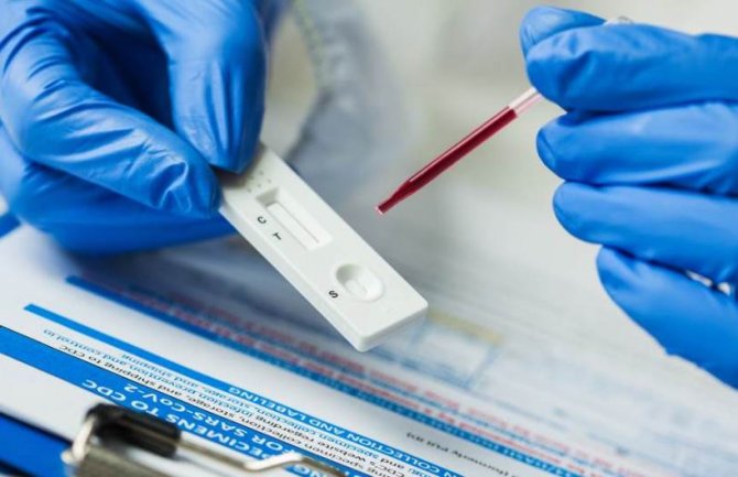 Jedan novi slučaj koronavirusa, ukupno 315 oboljelo