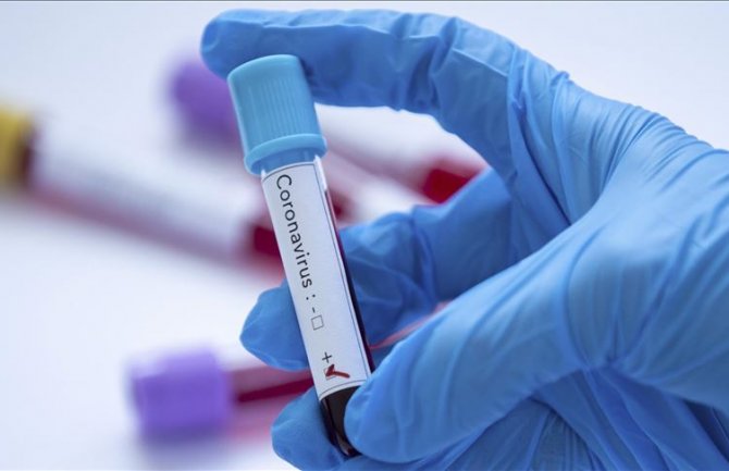 U BiH dvije nove žrtve koronarusa, broj preminulih porastao na 59