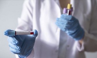 Srbija: U poslednja 24 sata preminule još tri osobe od koronavirusa 