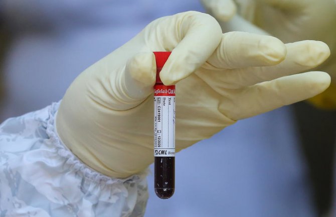 Osam pacijenata preminulo, 279 novopozitivnih 
