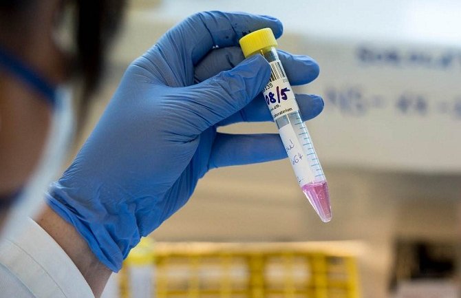 U Sjevernoj Makedoniji u posljednja 24 časa preminule dvije osobe od Covid-19, još 177 zaraženih