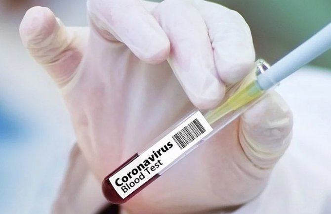 Tri preminula od koronavirusa u Sjevernoj Makedoniji