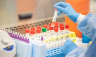 U posljednja 24 sata od korone u Srbiji umrlo osam osoba 