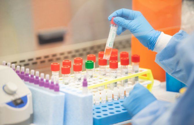 U posljednja 24 sata od korone u Srbiji umrlo osam osoba 