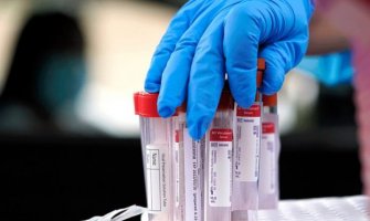 U Crnoj Gori danas 48 zaraženih, virus odnio još dva života 