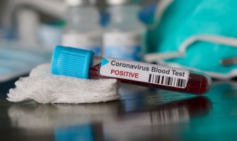 U Srbiji još šest osoba preminulo, 255 novozaraženih