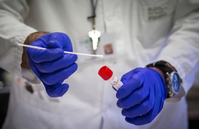 Povukli Rendoks testove za koronvirus iz bezbjednosnih razloga