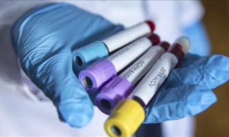 U Sj. Makedoniji od korone preminulo pet osoba, 127 inficiranih