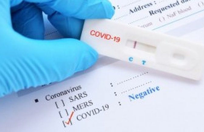 Oko 1.300 Britanaca dobilo netačne rezultate testa na koronu