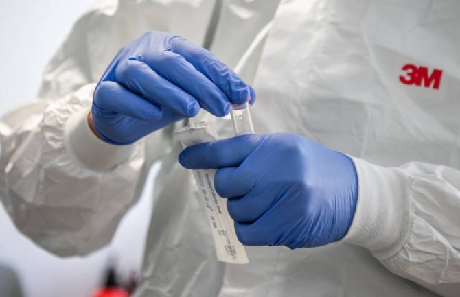 Novi presjek IJZ: 4 smrtna slučaja, 432 novopozitivna, 461 oporavljeni pacijent