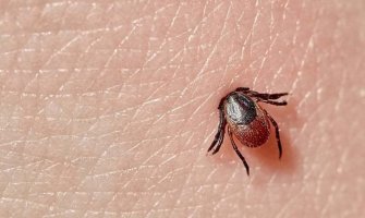 Počinje sezona krpelja: Kako ga pravilno izvući iz kože